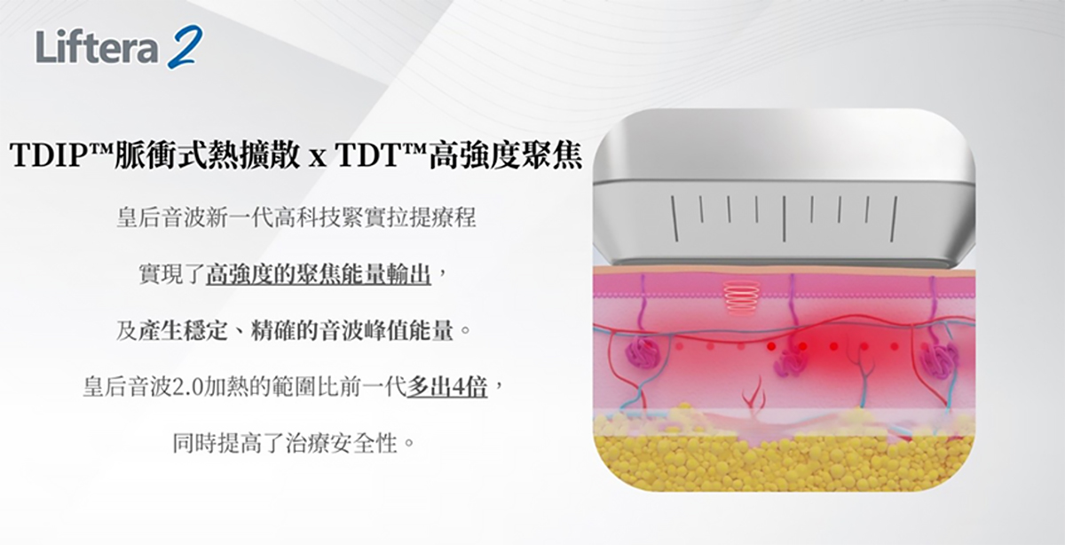 TDIP脈衝式熱擴散結合TDT高強度聚焦技術：皇后音波新一代高科技緊實拉提-致然雅暮醫美診所