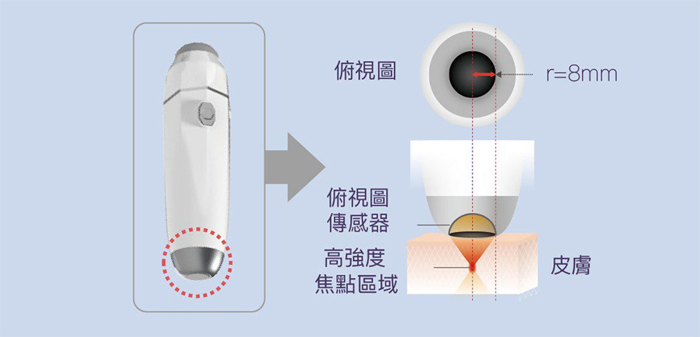 立特拉渦旋音波2.0輕巧筆型探頭：r=8mm精巧半徑，貼合眼周與細部輪廓-致然雅暮醫美診所