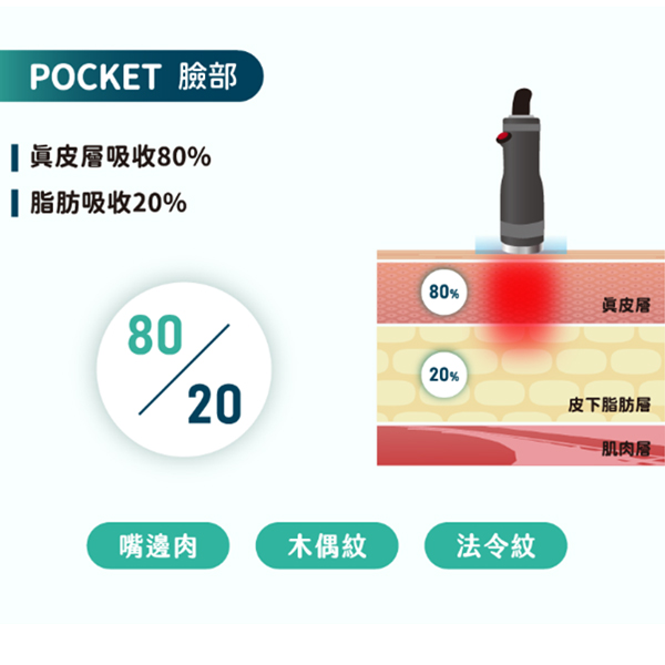 ONDA PRO昂達超微波核心技術：2.45GHz高頻微波直達脂肪層，搭配專利低溫冷卻調控確保療程舒適安全-致然雅暮醫美診所