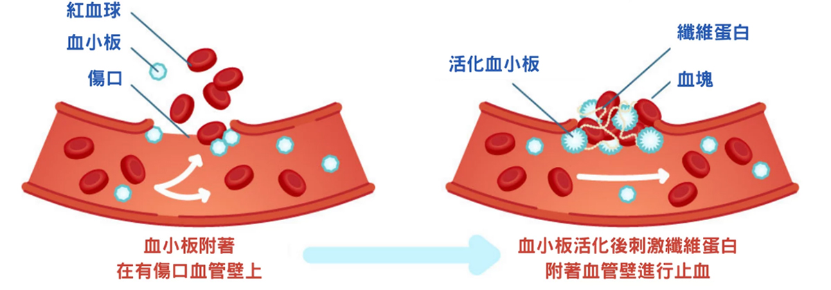 血小板附著與活化後刺激纖維蛋白附著血管壁進行止血修復-致然雅暮醫美診所