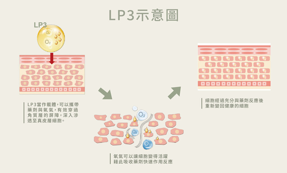 SEYO TDA作用原理二：富含玻尿酸與活性營養之精華分子，在不傷害組織的前提下，溫和穿透皮膚角質層並開啟細胞間隙通道